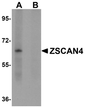 ZSCAN4 Antibody