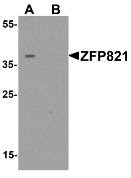 ZNF821 Antibody