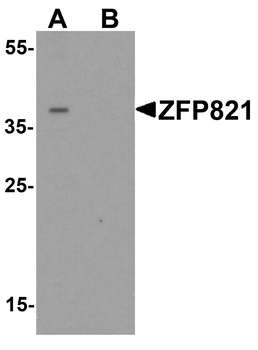 ZNF821 Antibody