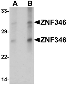 ZNF346 Antibody