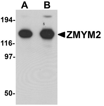 ZMYM2 Antibody