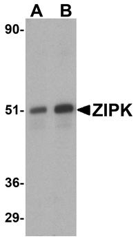 DAPK3 Antibody