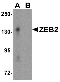 ZEB2 Antibody