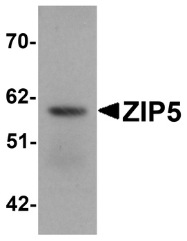 SLC39A5 Antibody