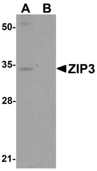 SLC39A3 Antibody