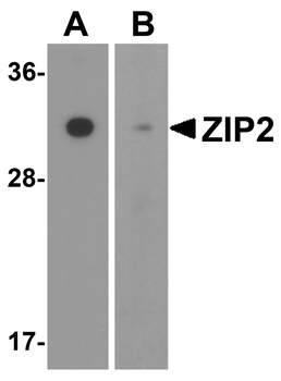 SLC39A2 Antibody