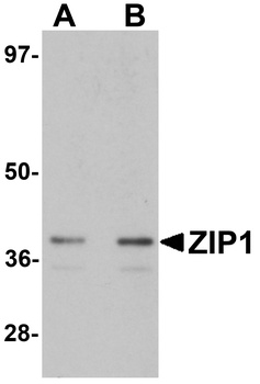 SLC39A1 Antibody