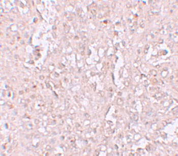 ZIP13 Antibody
