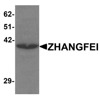 CREBZF Antibody