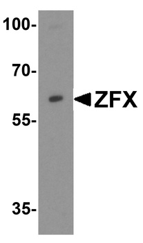 ZFX Antibody