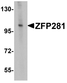 ZNF281 Antibody