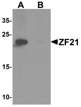 ZFYVE21 Antibody