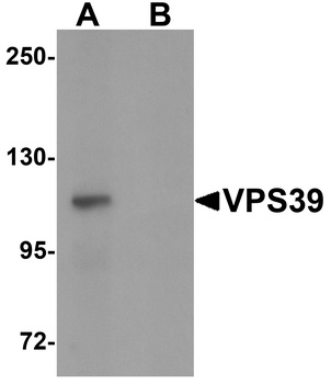 VPS39 Antibody