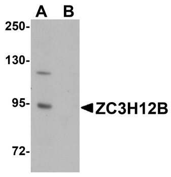 ZC3H12B Antibody