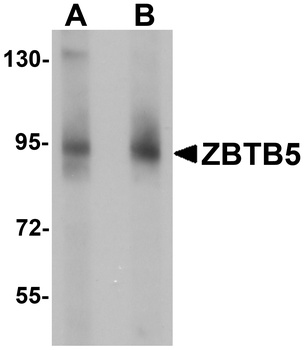 ZBTB5 Antibody