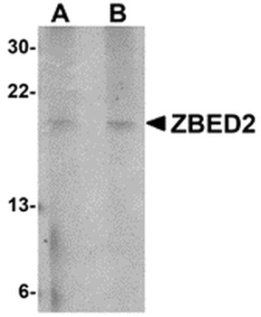 ZBED2 Antibody