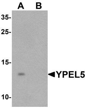 YPEL5 Antibody
