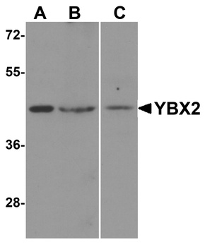 YBX2 Antibody