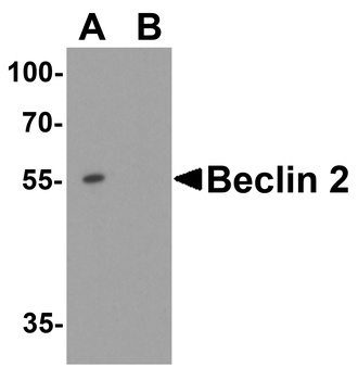 WWC1 Antibody