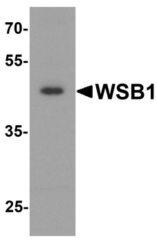 WSB1 Antibody