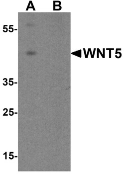 WNT5B Antibody