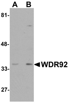 WDR92 Antibody
