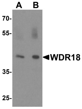 WDR18 Antibody