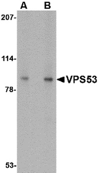 VPS53 Antibody