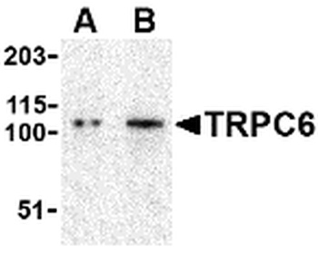 TRPC6 Antibody