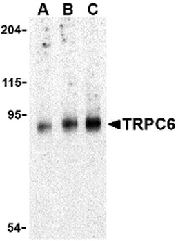 TRPC6 Antibody