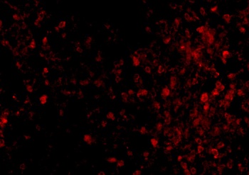 TRPC6 Antibody
