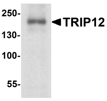 TRIP12 Antibody