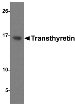TTR Antibody