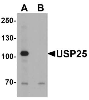 USP25 Antibody