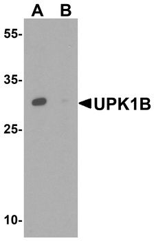UPK1B Antibody