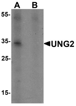 UNG Antibody