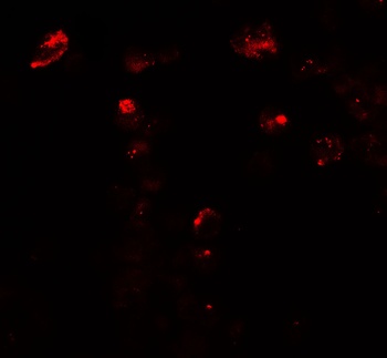 UNG Antibody