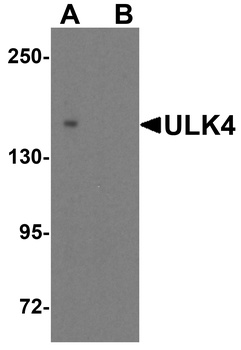 ULK4 Antibody