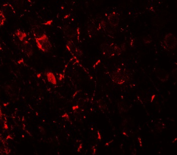 ULK1 Antibody