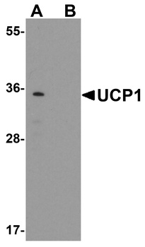 UCP1 Antibody