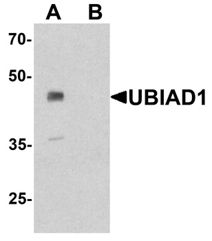UBIAD1 Antibody