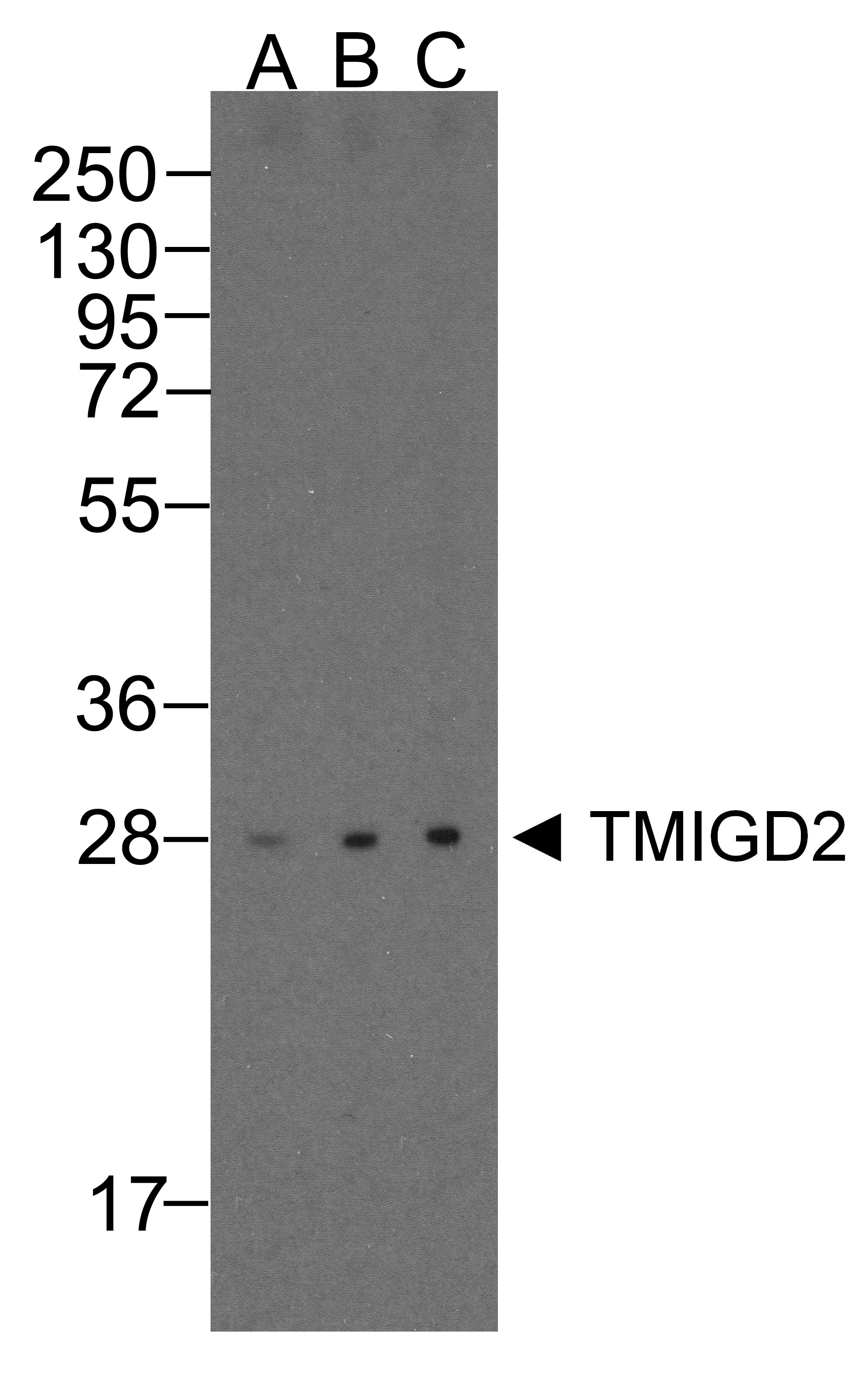 TMIGD2 Antibody