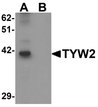 TRMT12 Antibody