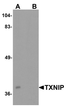 TXNIP Antibody