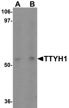 TTYH1 Antibody