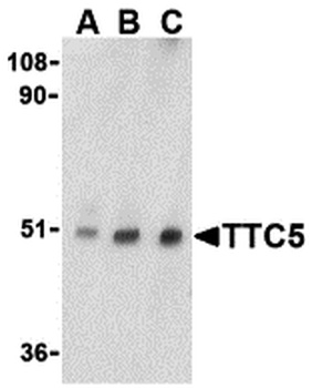 TTC5 Antibody