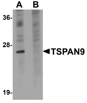 TSPAN9 Antibody