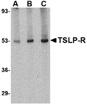 Crlf2 Antibody