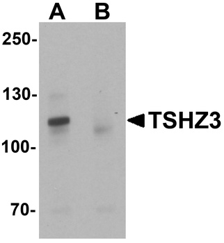 TSHZ3 Antibody