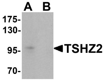 TSHZ2 Antibody